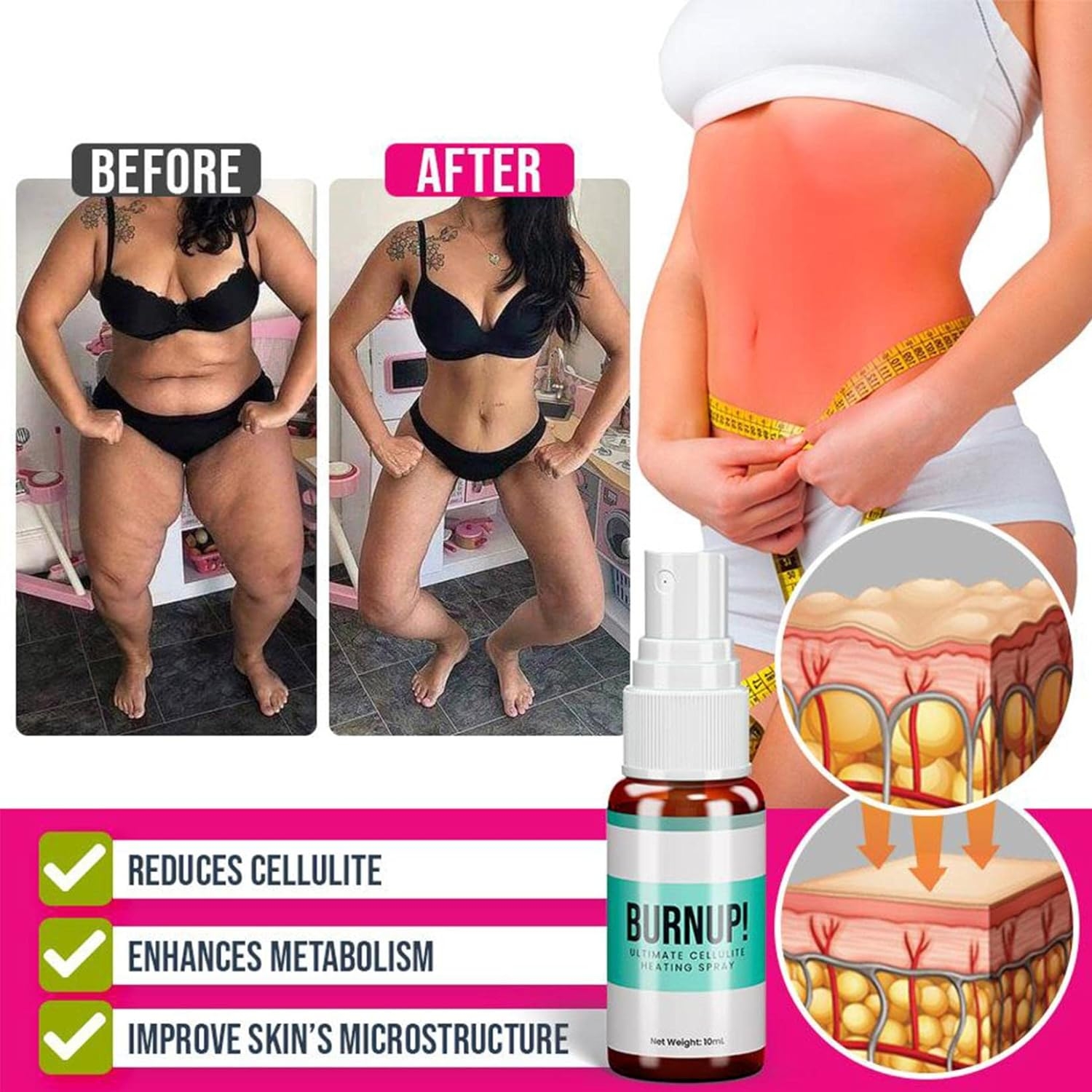 Ultimate Cellulite Heating Spray Tightening Cellulite Cream Improves Elasticity Plumps Sagging Skin Reduces Fat And Inhibits The Formation Of Fat Cells (1PCS)